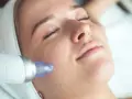Kobieta z zamkniętymi oczami poddaje się zabiegowi oczyszczania wodorowego. Urządzenie delikatnie dotyka jej policzka, zapewniając odświeżenie.
