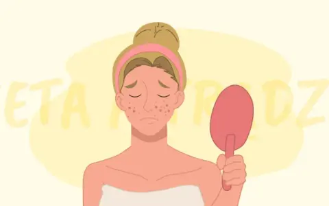 Smutna dziewczyna z trądzikiem na twarzy trzyma lusterko. Napis "DIETA A TRĄDZIK" sugeruje związek między dietą a problemami skórnymi.