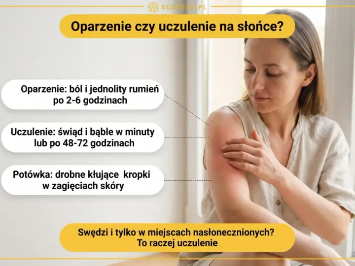 Kobieta z zaczerwienionym ramieniem, wskazującym na uczulenie na słońce. Obok tekst opisujący objawy oparzenia i uczulenia.